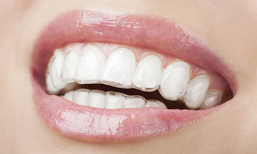 image of nice smile white teeth